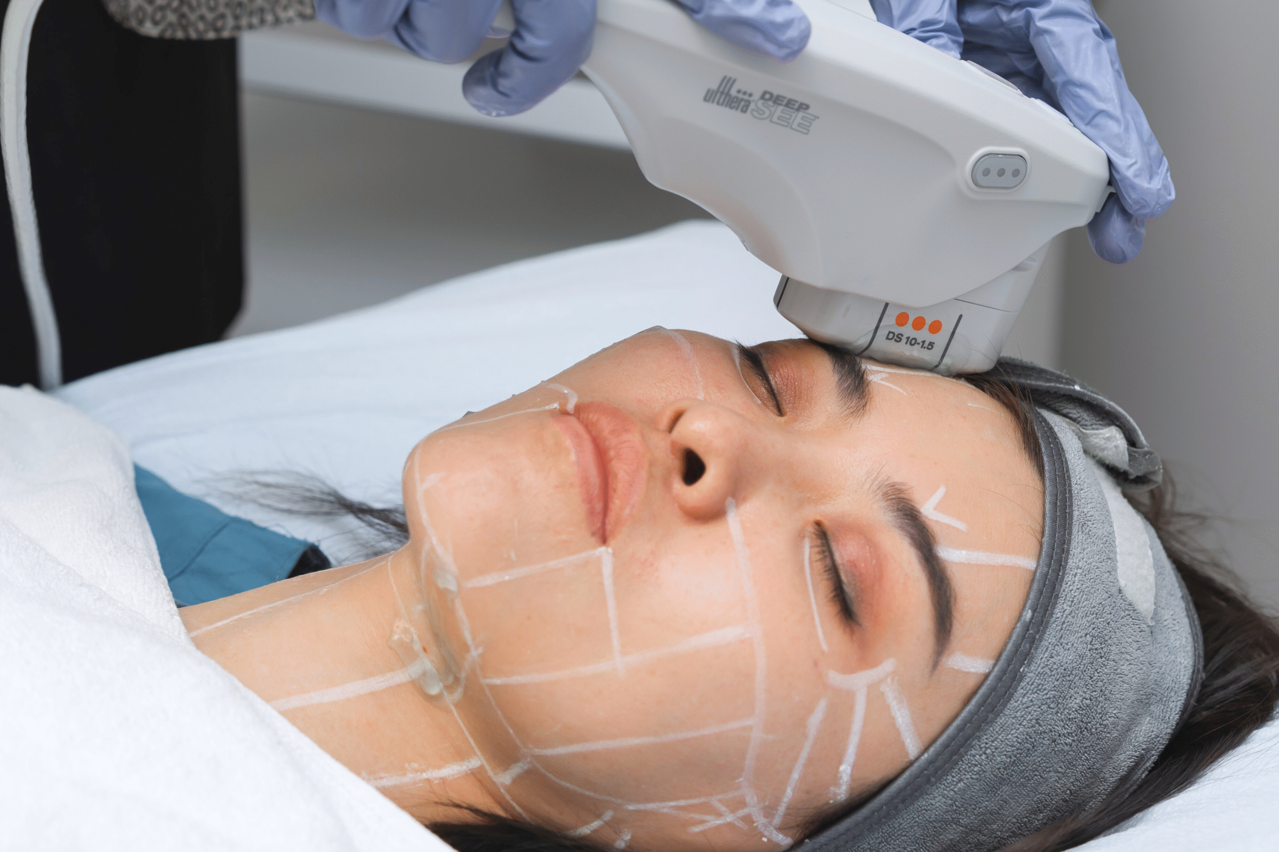 DeepSEE Ultrasound Visualization Technology