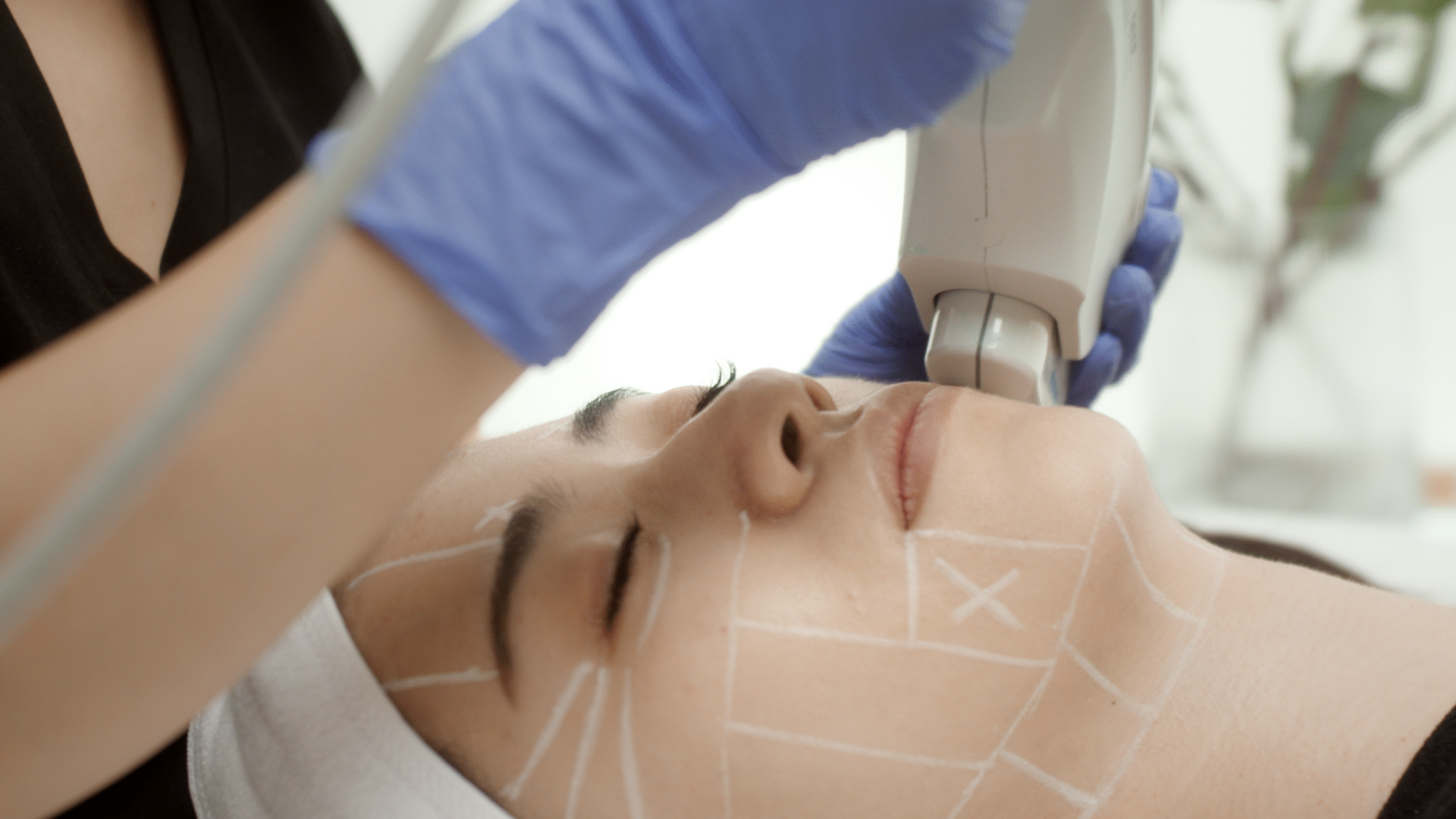 DeepSEE Ultrasound Visualization Technology