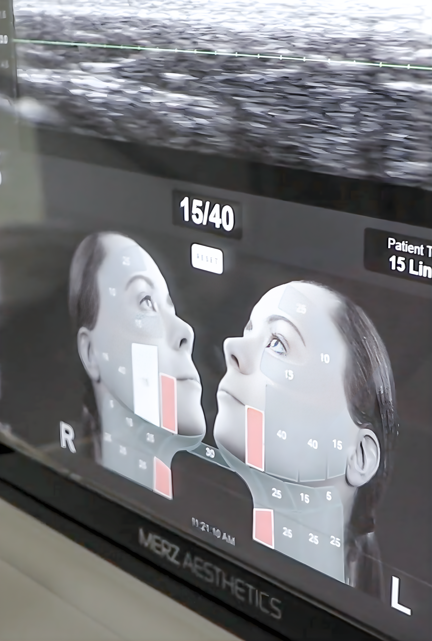 DeepSEE Ultrasound Visualization Technology