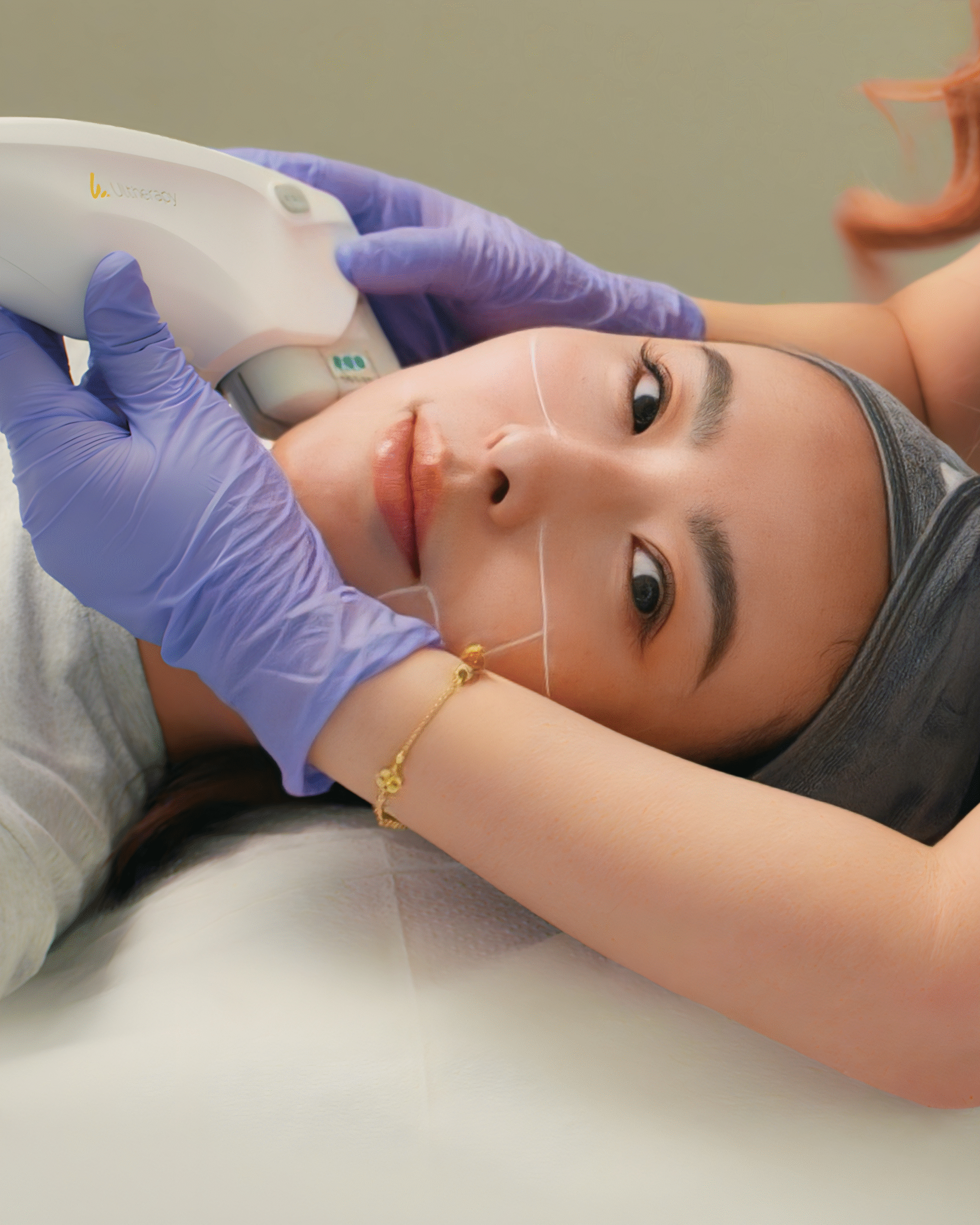 Ultherapy Prime Device